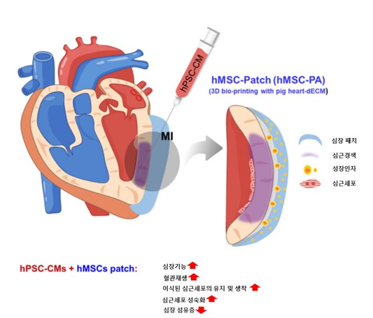 복합 줄기세포를 활용한 심근경색 심장재생 치료법 개발
