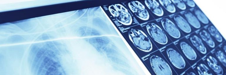 Presagen Federated Learning algorithm Decentralized AI Training