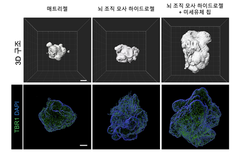 뇌 환경 유사 브레인 오가노이드 배양 플랫폼 개발