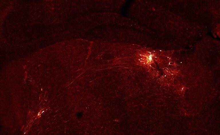 Brain circuit that focuses attention brings in wide array of inputs